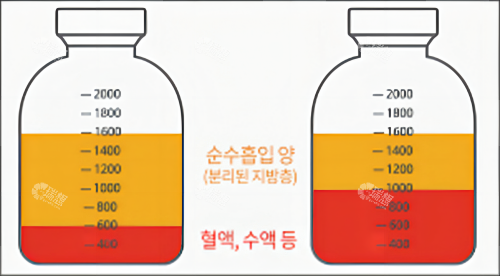 脂肪提取素材图